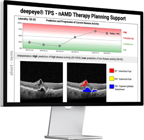 Topcon Healthcare in deepeye Medical vzpostavljata partnerstvo za uvedbo z AI vodenega načrtovanja retinalne terapije po vsej Evropi